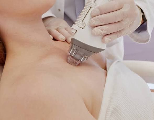 Fraksjonell Dual Laser for Bærum behandling