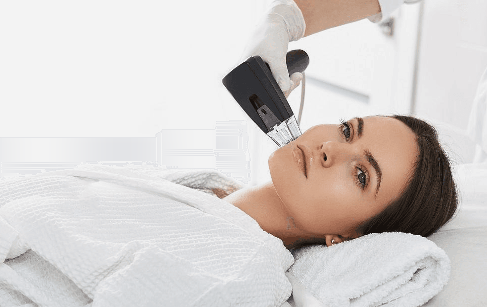 RF Microneedling