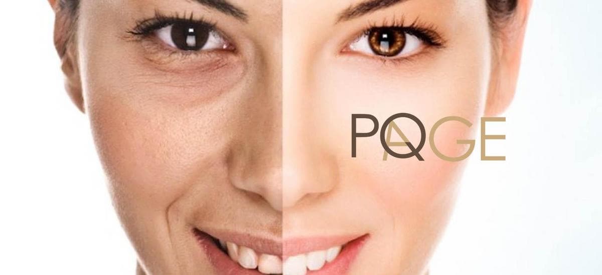 PQ Evolution Peeling