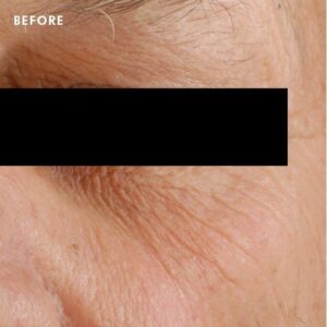 AGE-Eye-Complex-for-Dark-Circles-After-SkinCeuticals